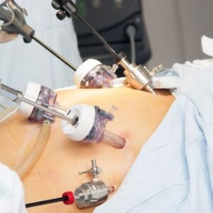 Negativa de cirurgia reparadoras pós procedimento bariátrico e reconstrução mamária;